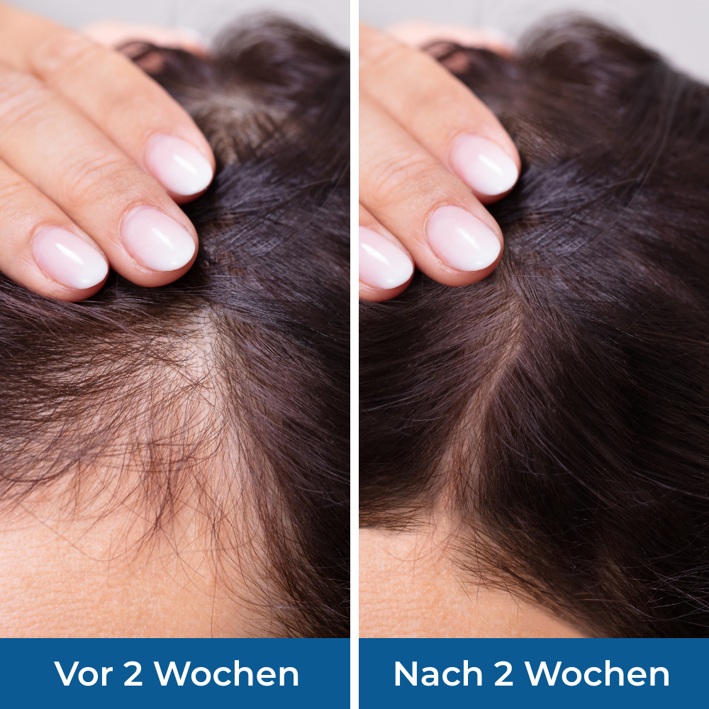 Groviva hair serum