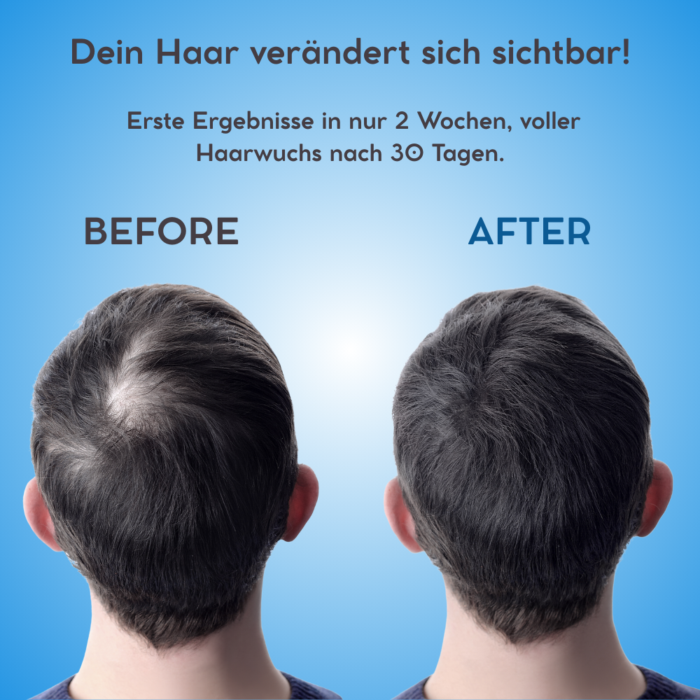 Groviva hair serum